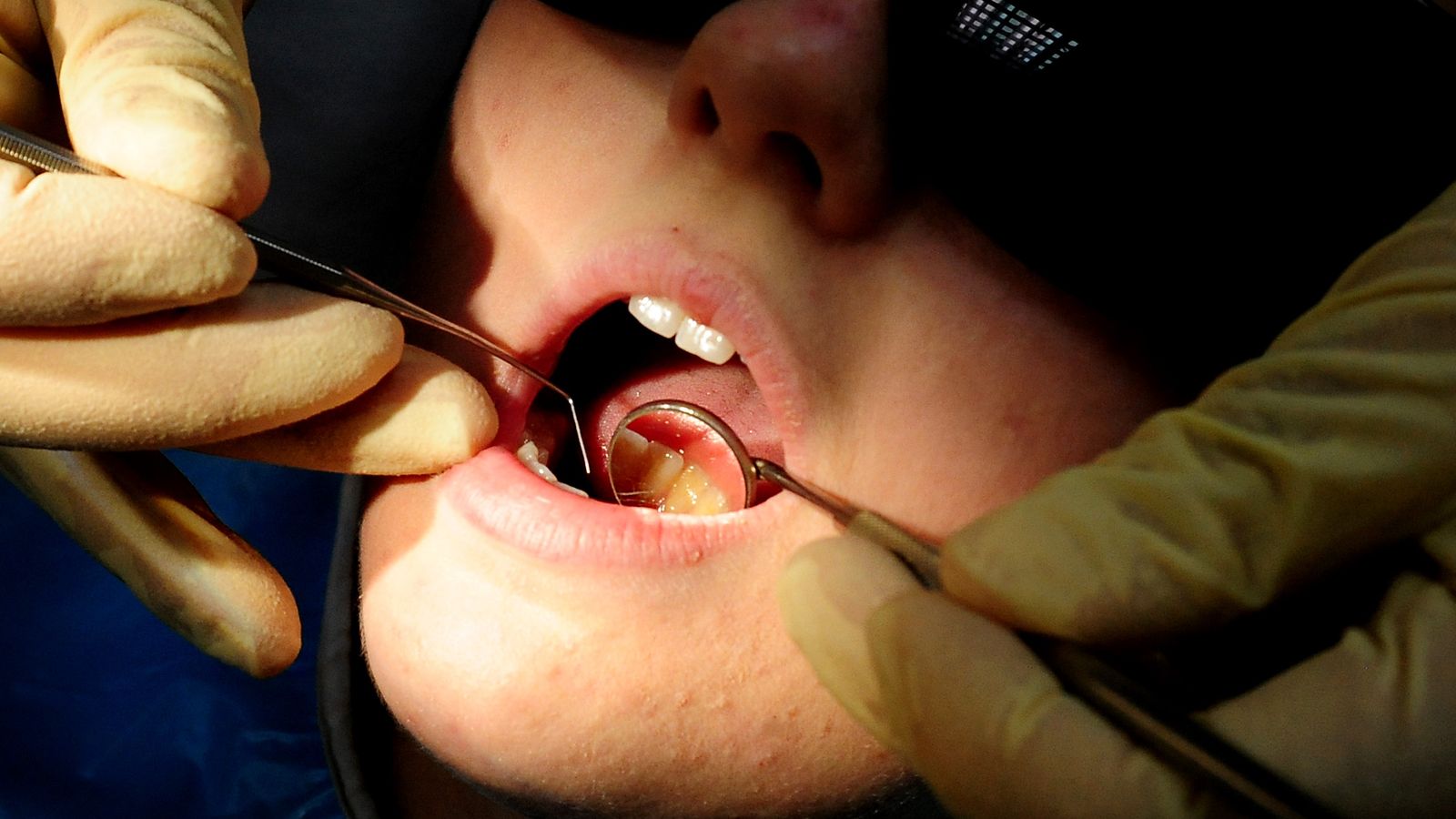 На зъболекарите ще бъдат предложени парични стимули за лечение на пациенти от NHS и работа в райони с недостатъчно обслужване
