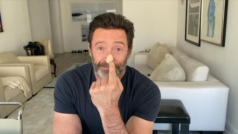 Hugh Jackman reveals new skin cancer scare - and urges fans to