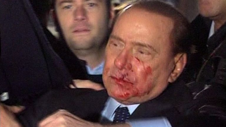 This video image made available by RAI TG3 shows Italian Premier Silvio Berlusconi after an attacker hurled a statuette at Berlusconi striking the leader in the face at the end of a rally in Milan, Italy on Sunday Dec. 13, 2009 leaving the 73-year-old media mogul with a bloodied mouth and looking stunned. (AP Photo/RAI TG3 via APTN) ** ITALY OUT **