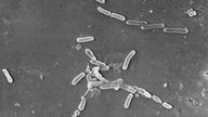 Microscope image of the Pseudomonas aeruginosa bacteria. Pic: AP 