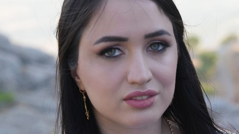 Turkish singer Mutlu Kaya was shot by an ex boyfriend