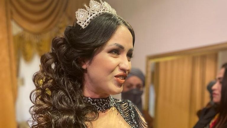 Turkish singer Mutlu Kaya was shot by an ex boyfriend