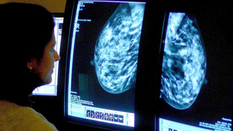 Consultant analyzing mammograms