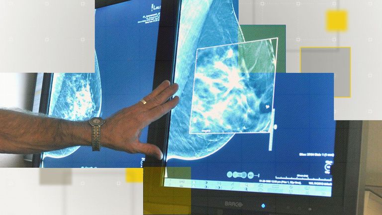 Cancer services are being stretched more than ever