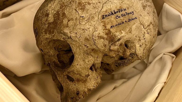One of the skulls snatched from Inishbofin