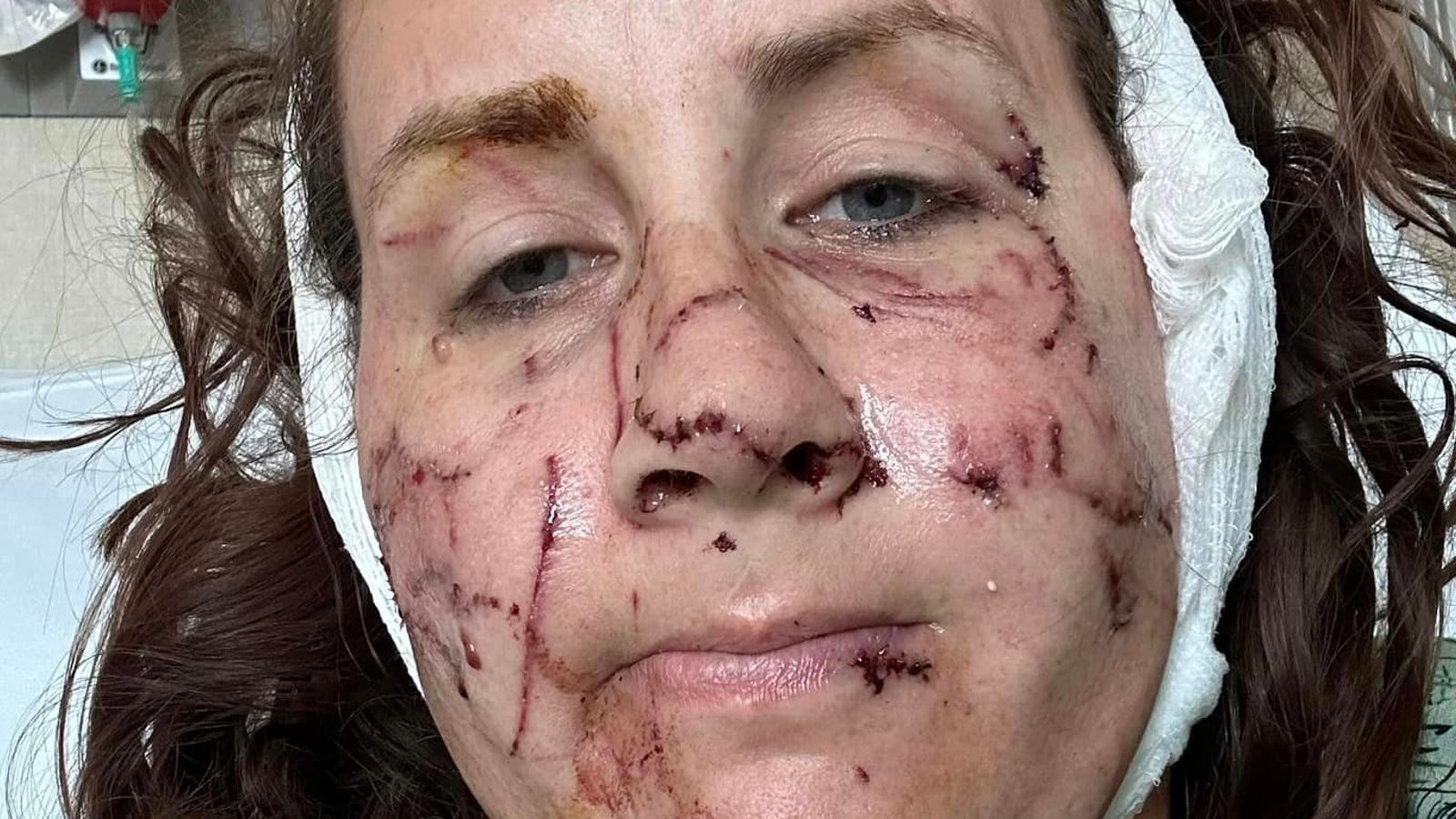 Три жени, ранени при нападение на видра в Монтана
