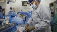 Surgeons at NYU Langone Health transplanted a kidney from a genetically modified pig on 14 July. Pic: AP