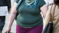 A woman suffering obesity walks in central London. 23rd April 2015. Daniel Leal-Olivas/PA