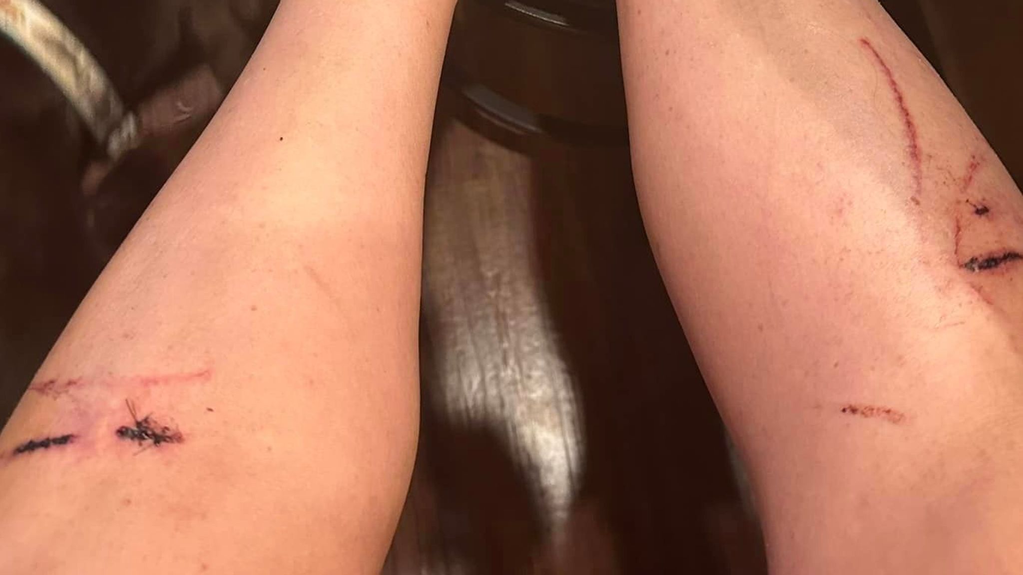 Three women injured in otter attack in Montana US News Sky News