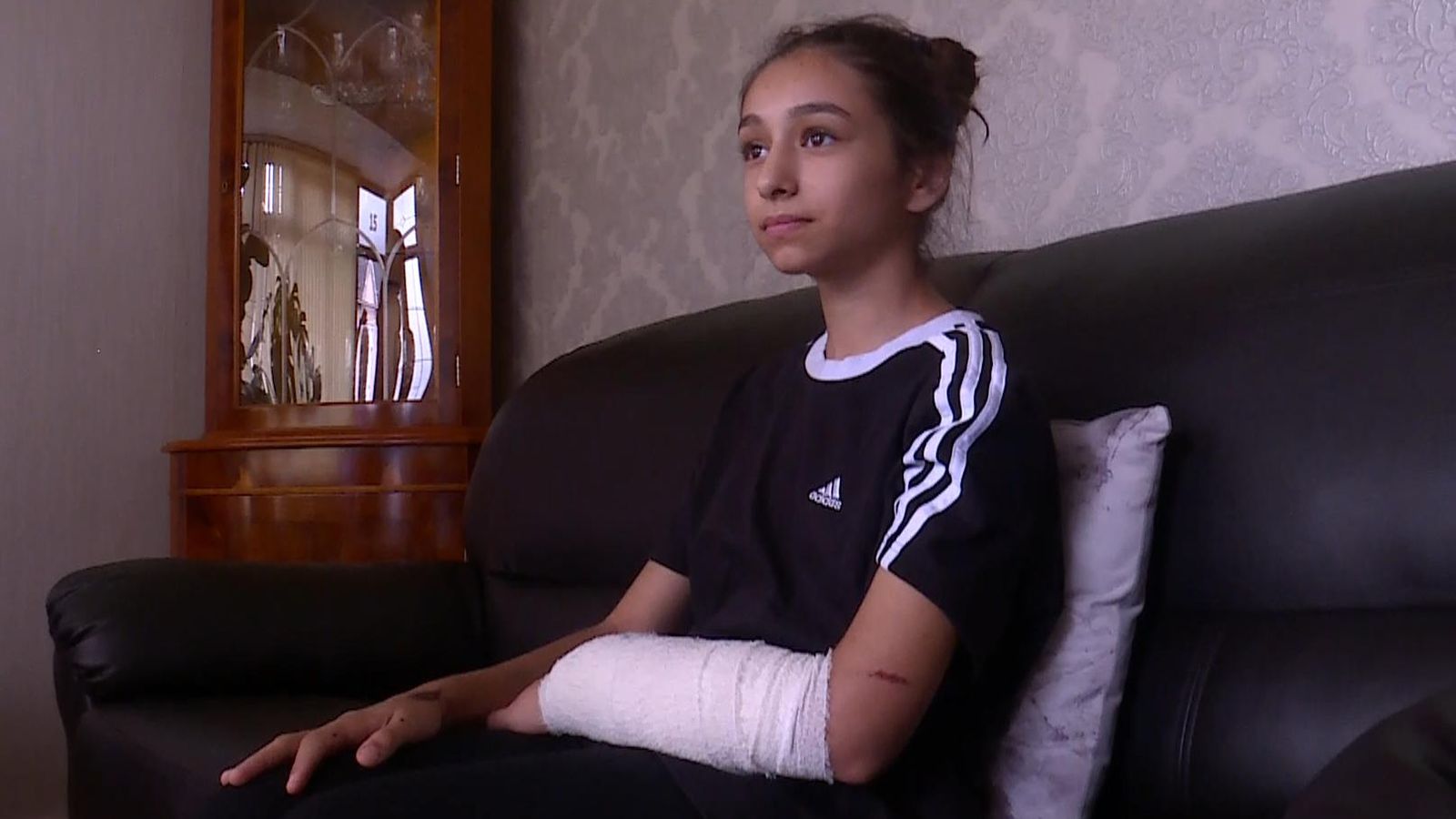 Girl, 11, attacked by XL bully crossbreed in Birmingham says dog should