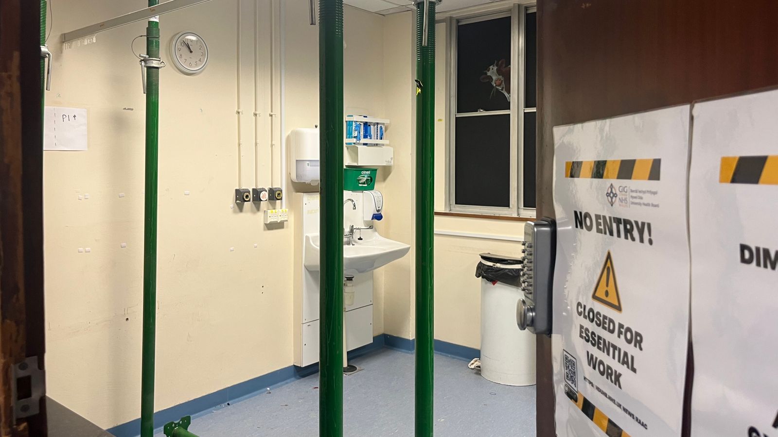 „Огромни смущения“, тъй като болницата в Пембрукшър с разпадащ се RAAC бетон е принудена да затвори половината от отделенията си