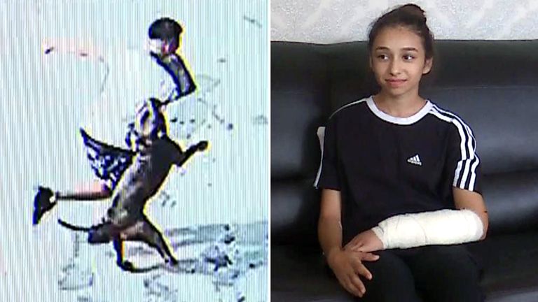 Girl, 11, attacked by XL bully crossbreed in Birmingham says dog should be put down and its owner jailed - Vimarsana News