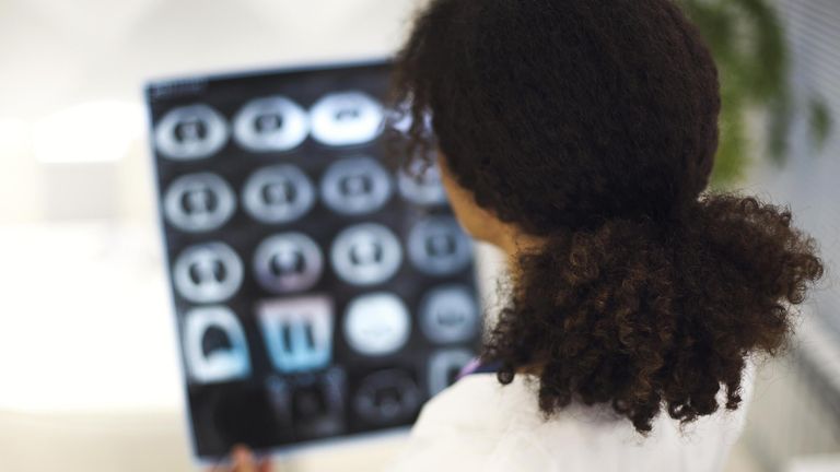 A doctor analyses scans at a hospital