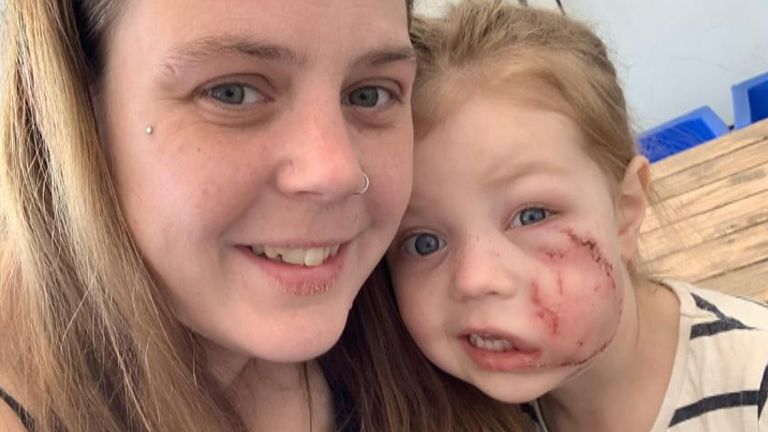 Mother of girl, 4, mauled by XL bully crossbreed 'glad' they will be banned after shocking images show injuries