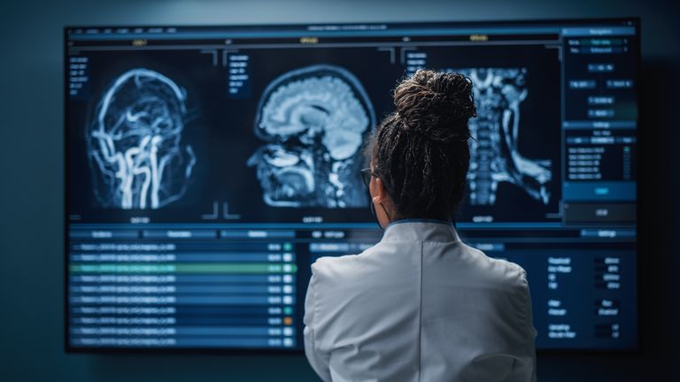 Medical Hospital Research Lab: Black Female Neuroscientist Looking at TV Screen, Analyzing Brain Scan MRI Images. Pic: iStock