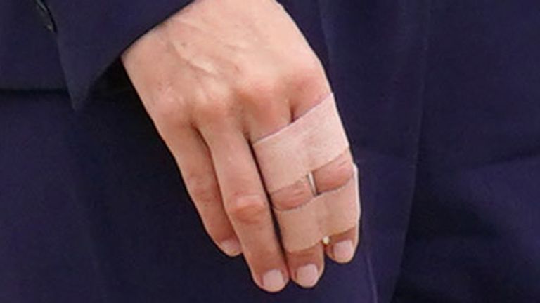 The Princess of Wales with bandages wrapped around her fingers during a visit to HMP High Down in Surrey, to learn about how the Forward Trust charity is supporting those in the criminal justice system to manage and recover from their addictions. Picture date: Tuesday September 12, 2023.