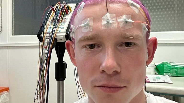 VC Pines (Jack Mercer) has used brain scans on the artwork for his music as he releases debut album MRI, inspired by his journey with epilepsy