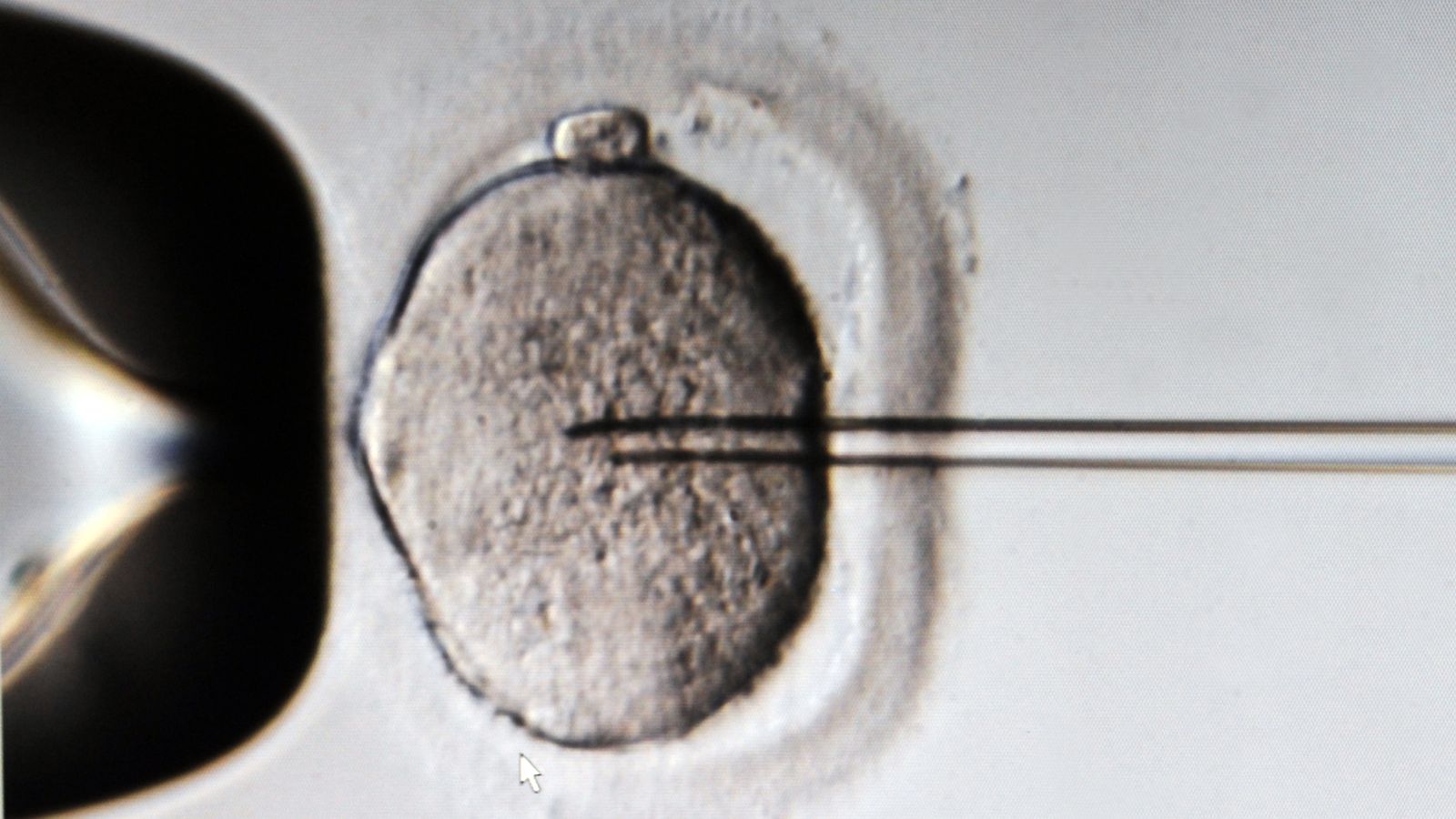 IVF: Повече от 100 пациенти в Guy`s and St Thomas` and Jessop Fertility „изложени на повредена течност за замразяване на яйцеклетки и ембриони“