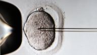 Sperm being injected into an egg cell during IVF. File pic (AP)