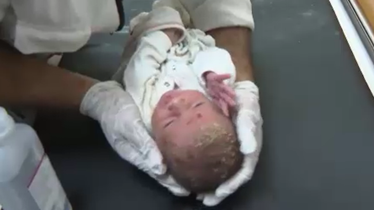 Wounded baby in Gaza hospital