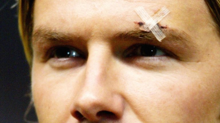A plaster is visible over the injured left eyebrow of Manchester United mid-fielder David Beckham, during the team line-up, before kick-off in the UEFA Champions League group D match against Juventus at Old Trafford, Manchester. *  The rumoured rift between David Beckham and his club boss Sir Alex Ferguson looked dead and buried today after the midfield maestro helped Manchester United to a vital European victory. Just days after a dressing room bust-up saw Sir Alex accidentally kick a football boot into Beckham&#39;s face, cutting him above the eye, the pair at last had something to smile about. The Old Trafford side beat visitors and Italian giants Juventus in the Champions League 2-1 last night with Beckham providing the crucial ball for both home goals.