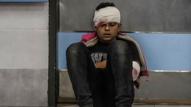 Palestinian child injured in an Israeli shelling on the Ahli Arab hospital