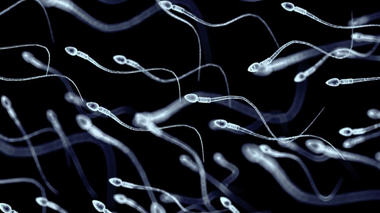 Sperm count may be affected by mobile phone use. File pic
