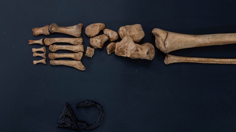 Remains of the woman found at the 17th century cemetery for rejected people in the village of Pien, northern Poland, are revealed by Polish archaeologists from Nicolas Copernicus University, in Torun, Poland October 27, 2023. The woman&#39;s body was found with a padlock on her leg and a sickle around the neck which suggest the person was believed to be a &#39;vampire&#39; and was secured to the ground to avoid &#39;her rising from the grave&#39;. REUTERS/Lukasz Glowala
