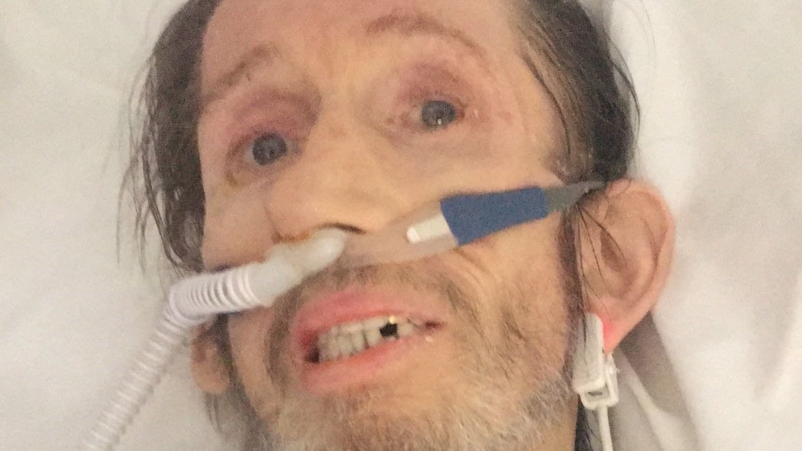 Shane MacGowan's wife thanks well-wishers as The Pogues frontman is pictured in hospital bed
