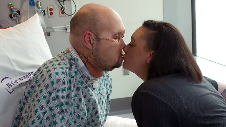 Aaron James kissed his wife Meagan after the surgery