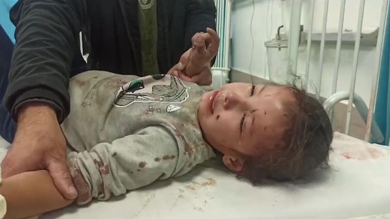 An injured child at the Gaza European hospital