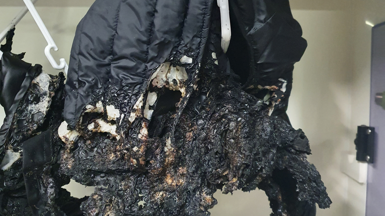 Mohammed Rayaz&#39;s burnt jacket
