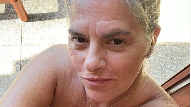 Tracey Emin has said she is recovering after her &#39;small intestine nearly exploded&#39;. Pic: @traceyeminstudio