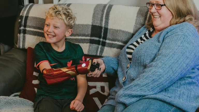 A 10-year-old has been gifted a &#39;hero&#39; bionic arm for Christmas by the NHS.