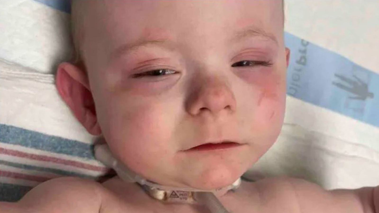Ohio police raid on 'wrong house' left sick baby with burns, mum claims
