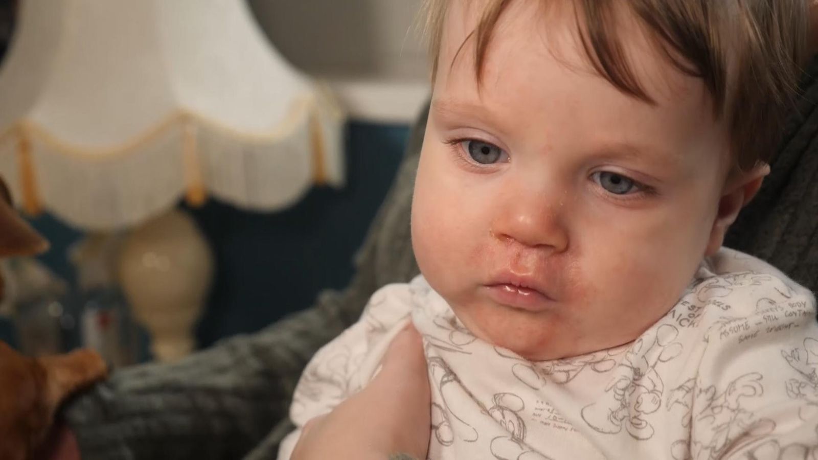 Mother whose baby caught measles calls for MMR jab to be offered earlier than one year