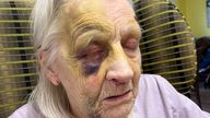 Jeanette Clayton had concerns about how frequently their mum would fall, leaving her with facial bruises and other injuries.  Image supplied for Shingi dementia story.