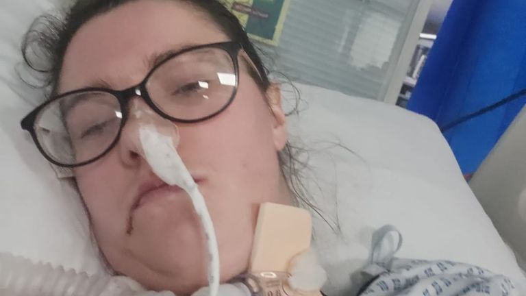 Morgan Sinnott is on a ventilator after being hospitalised with pneumonia