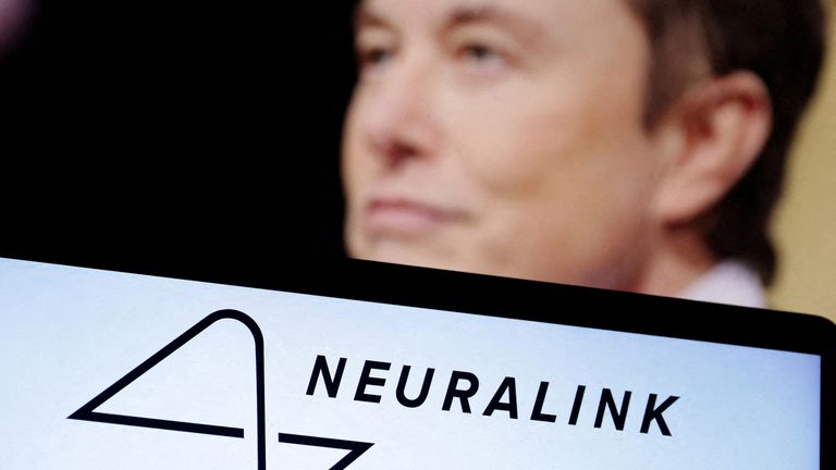 Musk said &#39;initial results show promising neuron spike detection&#39;