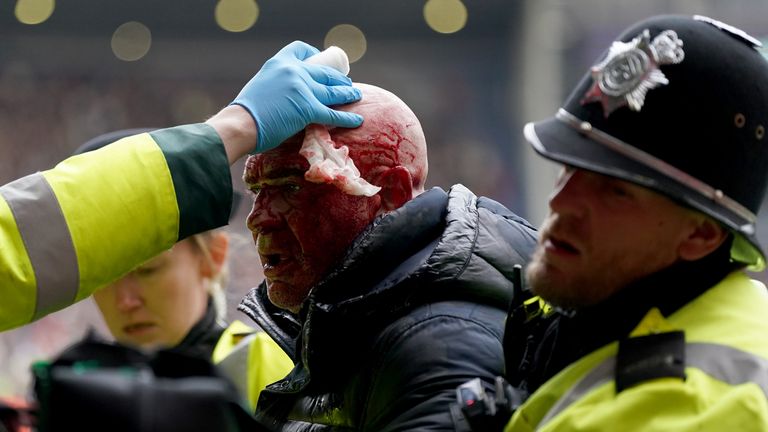Police officers remove a fan who received a cut to his head during clashes in the stands during the Emirates FA Cup fourth round match at The Hawthorns, West Bromwich. Picture date: Sunday January 28, 2024.

