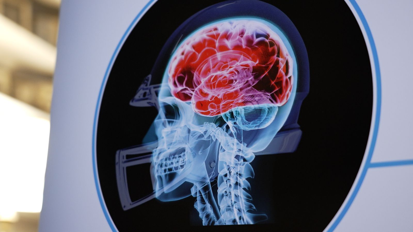 Is there a link between CTE brain disease and violent crime?