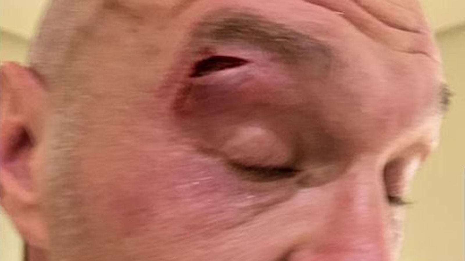 Tyson Fury v Oleksandr Usyk: British boxer 'devastated' after 'freak' sparring injury forces fight postponement