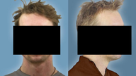 Christian B&#39;s identity cannot be revealed under Germany privacy laws