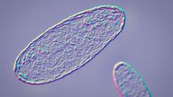 Illustration o fthe Plague bacterium Yersinia pestis.
Pic: Istock