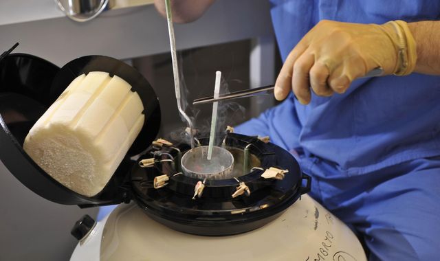 Hospital apologises after frozen eggs of more than 100 women may have been damaged - Vimarsana News