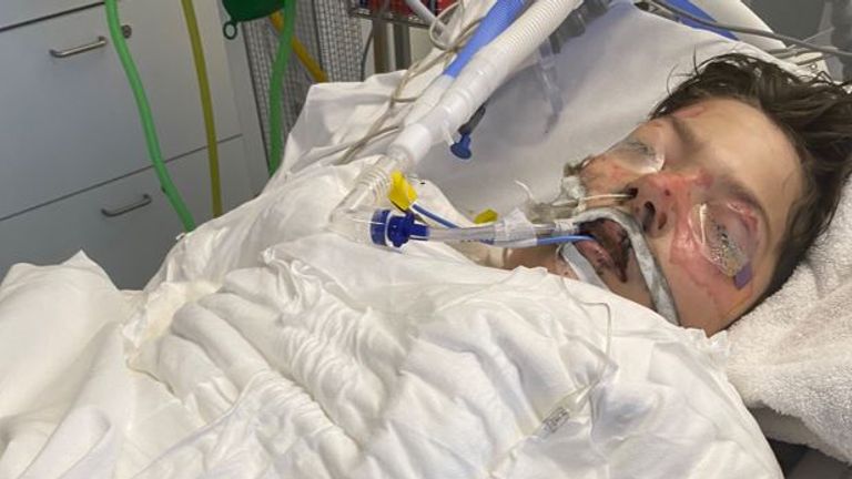 Blaine Beattie recovering in hospital. Pic: County Durham and Darlington Fire and Rescue Service