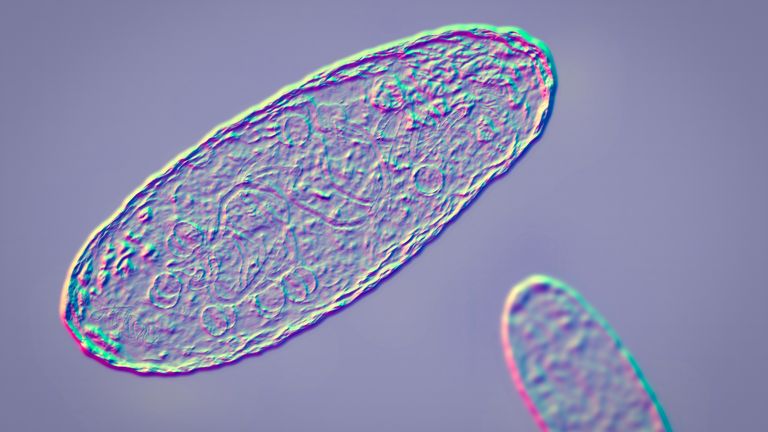 Illustration o fthe Plague bacterium Yersinia pestis.
Pic: Istock