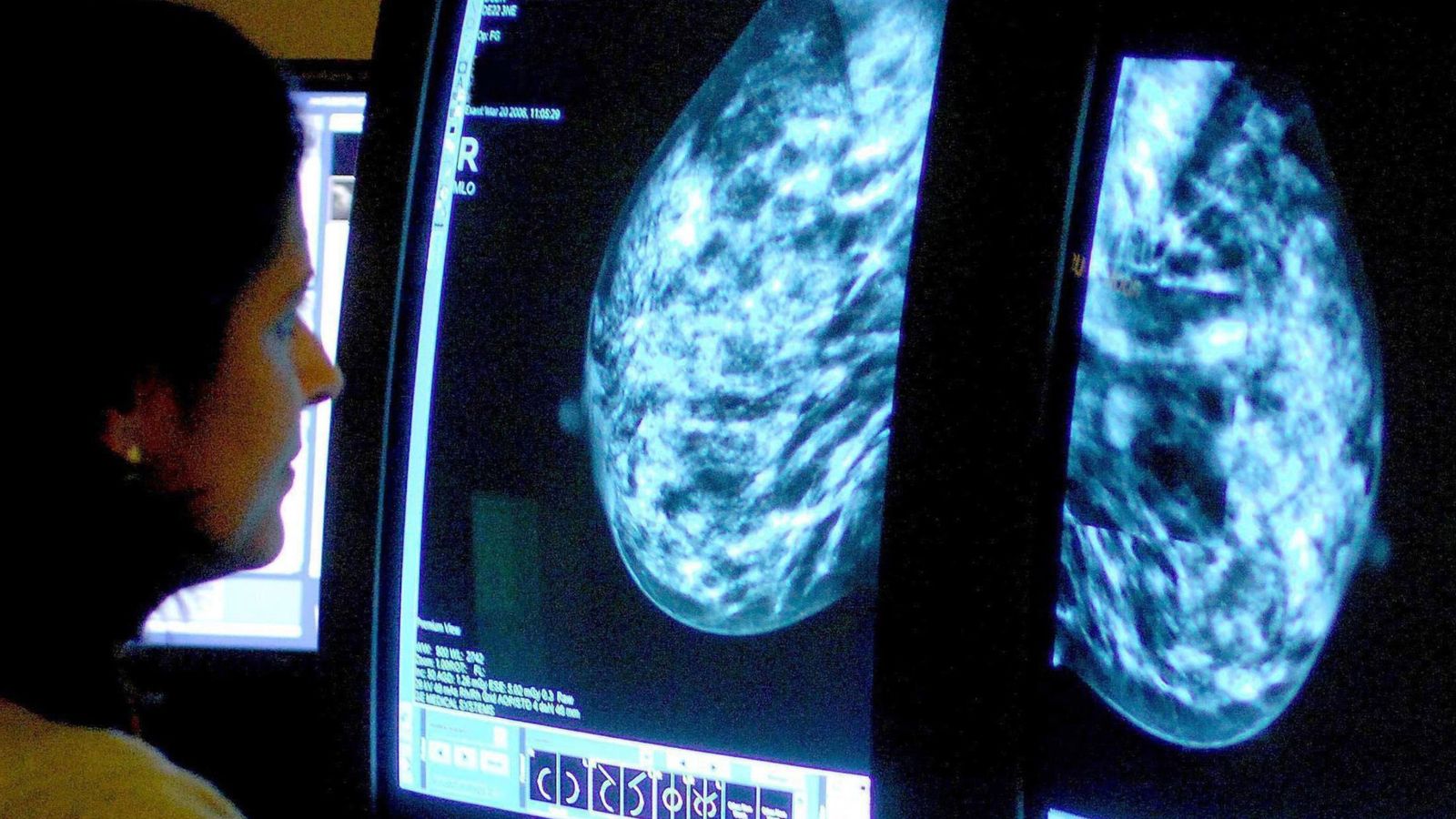 تشير الأبحاث إلى أن العلاجات الوقائية للسرطان يمكن أن “تهدئ المرض” ثم تعود  أخبار المملكة المتحدة