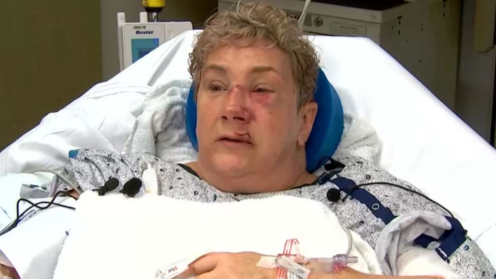 Pennsylvania woman thought she was 'going to die' after bear jumped over garden fence and started attacking her