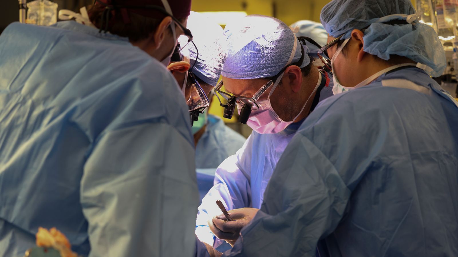 US man gets pig kidney in groundbreaking transplant